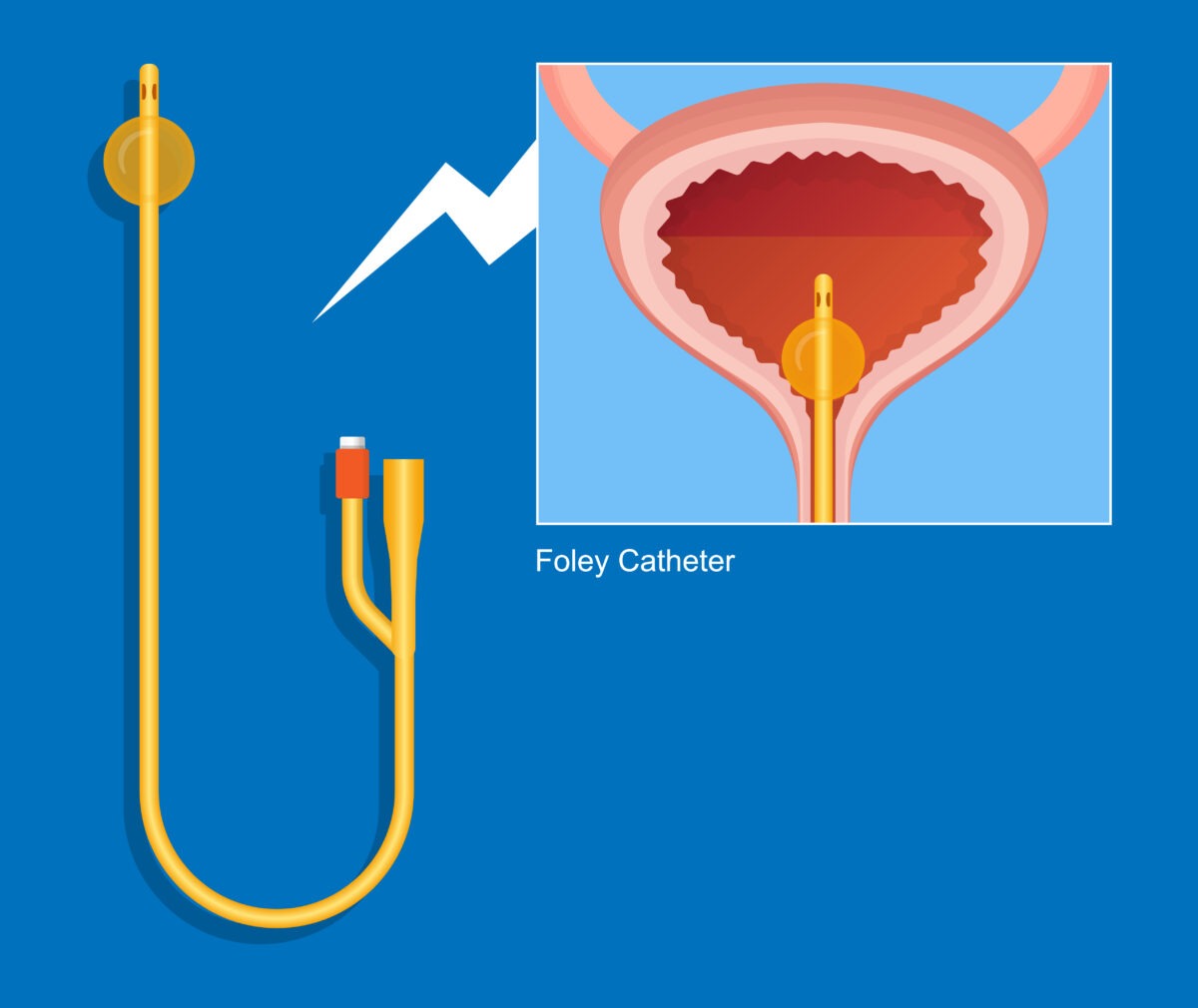 Catheter Awareness Training - Momentum People