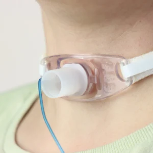 Tracheostomy in a adult woman
