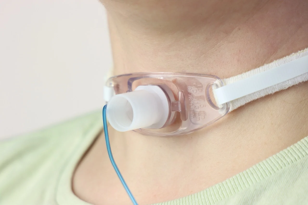 Tracheostomy in a adult woman